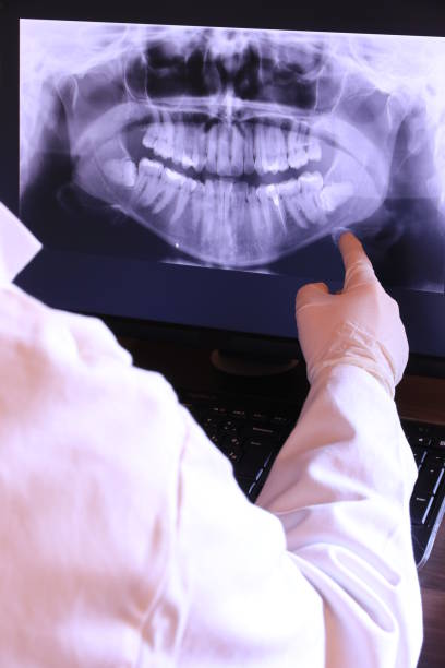 Best Emergency Root Canal Therapy in Necedah, WI